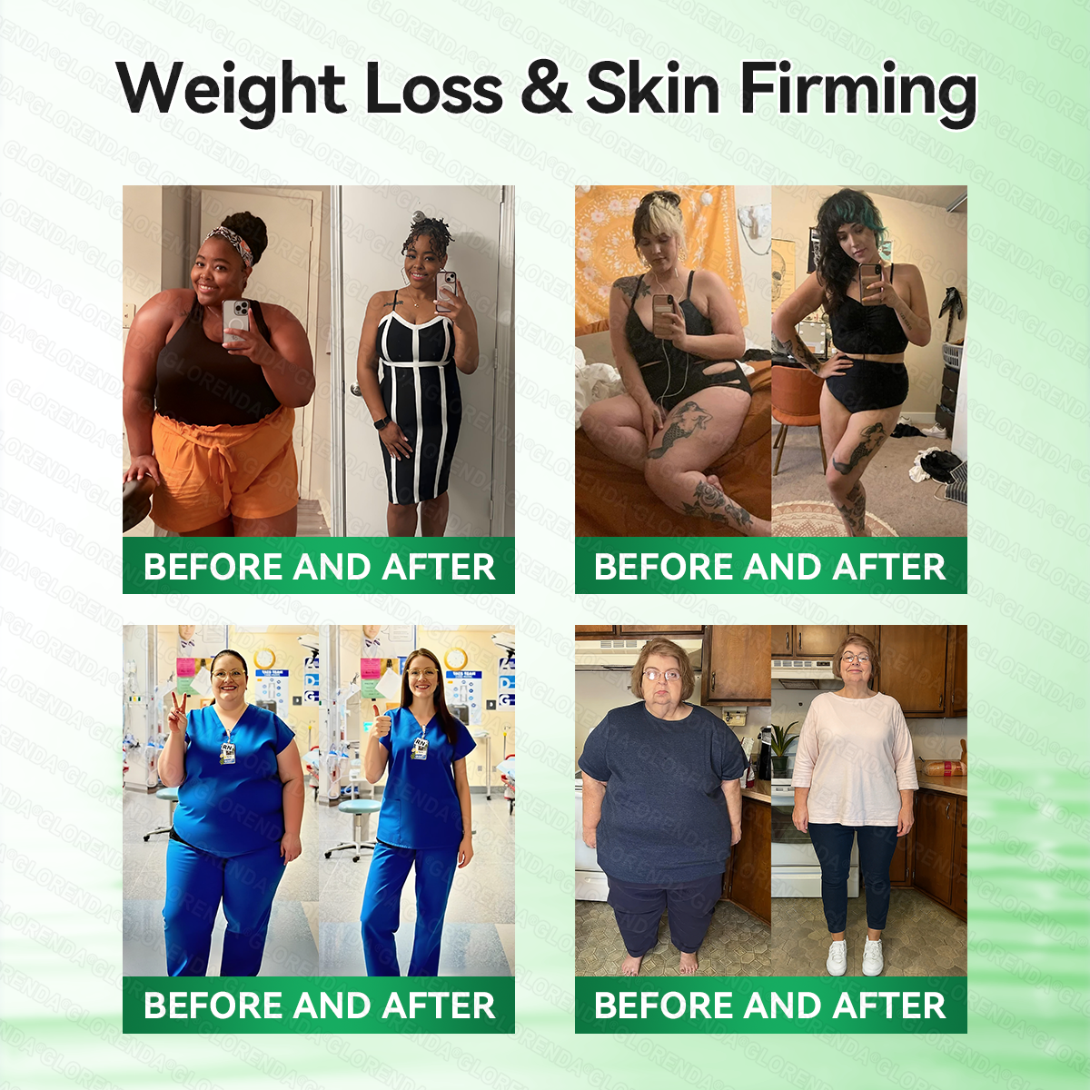 𝗖𝗔 𝑶𝒇𝒇𝒊𝒄𝒊𝒂𝒍 𝑺𝒕𝒐𝒓𝒆  |🍁🍁𝐂𝐚𝐫𝐞𝐔𝐩𝐥𝐢𝐟𝐭® 𝙈𝒐𝒓𝒊𝒏𝒈𝗮 · 𝗕𝗲𝗿𝗯𝐞𝐫𝐢𝐧𝙚 × 𝙉𝑨𝑫+ 𝟏𝟎-𝙞𝙣-𝟏 𝘼𝒅𝒗𝒂𝒏𝒄𝒆𝐝 𝐍𝐚𝐧𝙤 𝙈𝙞𝙘𝙧𝙤𝙣𝒆𝒆𝒅𝒍𝐞 𝐏𝐚𝐭𝙘𝙝(𝐉𝐮𝐬𝐭 𝐨𝐧𝐜𝐞 𝐚 𝐝𝐚𝐲,𝐯𝐢𝐬𝐢𝐛𝐥𝐞 𝐜𝐡𝐚𝐧𝐠𝐞𝐬 𝐢𝐧 𝟕 𝐝𝐚𝐲𝐬）✅𝐅𝐨𝐫 𝐨𝐛𝐞𝐬𝐢𝐭𝐲,🅛🅞🅞🅢🅔 🅢🅚🅘🅝,𝐝𝐢𝐚𝐛𝐞𝐭𝐞𝐬,𝐬𝐥𝐞𝐞𝐩 𝐚𝐩𝐧𝐞𝐚,𝐣𝐨𝐢𝐧𝐭 𝐢𝐬𝐬𝐮𝐞𝐬,𝐚𝐧𝐝 𝐦𝐨𝐫𝐞