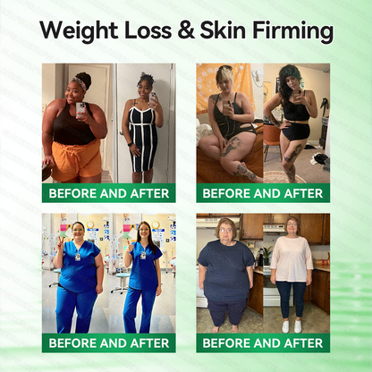 𝗖𝗔 𝑶𝒇𝒇𝒊𝒄𝒊𝒂𝒍 𝑺𝒕𝒐𝒓𝒆  |🍁🍁𝐂𝐚𝐫𝐞𝐔𝐩𝐥𝐢𝐟𝐭® 𝙈𝒐𝒓𝒊𝒏𝒈𝗮 · 𝗕𝗲𝗿𝗯𝐞𝐫𝐢𝐧𝙚 × 𝙉𝑨𝑫+ 𝟏𝟎-𝙞𝙣-𝟏 𝘼𝒅𝒗𝒂𝒏𝒄𝒆𝐝 𝐍𝐚𝐧𝙤 𝙈𝙞𝙘𝙧𝙤𝙣𝒆𝒆𝒅𝒍𝐞 𝐏𝐚𝐭𝙘𝙝(𝐉𝐮𝐬𝐭 𝐨𝐧𝐜𝐞 𝐚 𝐝𝐚𝐲,𝐯𝐢𝐬𝐢𝐛𝐥𝐞 𝐜𝐡𝐚𝐧𝐠𝐞𝐬 𝐢𝐧 𝟕 𝐝𝐚𝐲𝐬）✅𝐅𝐨𝐫 𝐨𝐛𝐞𝐬𝐢𝐭𝐲,🅛🅞🅞🅢🅔 🅢🅚🅘🅝,𝐝𝐢𝐚𝐛𝐞𝐭𝐞𝐬,𝐬𝐥𝐞𝐞𝐩 𝐚𝐩𝐧𝐞𝐚,𝐣𝐨𝐢𝐧𝐭 𝐢𝐬𝐬𝐮𝐞𝐬,𝐚𝐧𝐝 𝐦𝐨𝐫𝐞