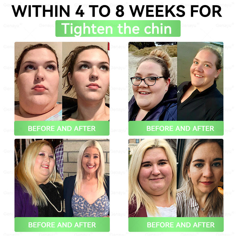 👩‍⚕️𝙑𝙞𝙩𝙖𝙍𝙖𝙘𝙚® Superfood 𝑵𝒂𝒏𝒐 𝑴𝒊𝒄𝒓𝒐𝒏𝒆𝒆𝒅𝒍𝒆 𝑷𝒂𝒕𝒄𝒉🎁(𝐉𝐮𝐬𝐭 𝐨𝐧𝐜𝐞 𝐚 𝐝𝐚𝐲, 𝐯𝐢𝐬𝐢𝐛𝐥𝐞 𝐜𝐡𝐚𝐧𝐠𝐞𝐬 𝐢𝐧 𝟕 𝐝𝐚𝐲𝐬）✅ 𝐅𝐨𝐫 𝐨𝐛𝐞𝐬𝐢𝐭𝐲, 𝗟𝗼𝗼𝘀𝗲 𝘀𝗸𝗶𝗻,𝐝𝐢𝐚𝐛𝐞𝐭𝐞𝐬, 𝐬𝐥𝐞𝐞𝐩 𝐚𝐩𝐧𝐞𝐚, 𝐣𝐨𝐢𝐧𝐭 𝐢𝐬𝐬𝐮𝐞𝐬, 𝐚𝐧𝐝 𝐦𝐨𝐫𝐞 💥💥
