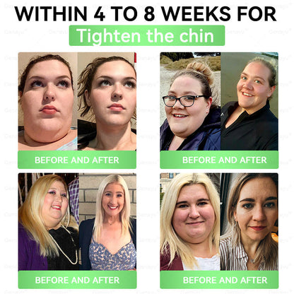 👩‍⚕️𝙑𝙞𝙩𝙖𝙍𝙖𝙘𝙚® Superfood 𝑵𝒂𝒏𝒐 𝑴𝒊𝒄𝒓𝒐𝒏𝒆𝒆𝒅𝒍𝒆 𝑷𝒂𝒕𝒄𝒉🎁(𝐉𝐮𝐬𝐭 𝐨𝐧𝐜𝐞 𝐚 𝐝𝐚𝐲, 𝐯𝐢𝐬𝐢𝐛𝐥𝐞 𝐜𝐡𝐚𝐧𝐠𝐞𝐬 𝐢𝐧 𝟕 𝐝𝐚𝐲𝐬）✅ 𝐅𝐨𝐫 𝐨𝐛𝐞𝐬𝐢𝐭𝐲, 𝗟𝗼𝗼𝘀𝗲 𝘀𝗸𝗶𝗻,𝐝𝐢𝐚𝐛𝐞𝐭𝐞𝐬, 𝐬𝐥𝐞𝐞𝐩 𝐚𝐩𝐧𝐞𝐚, 𝐣𝐨𝐢𝐧𝐭 𝐢𝐬𝐬𝐮𝐞𝐬, 𝐚𝐧𝐝 𝐦𝐨𝐫𝐞 💥💥